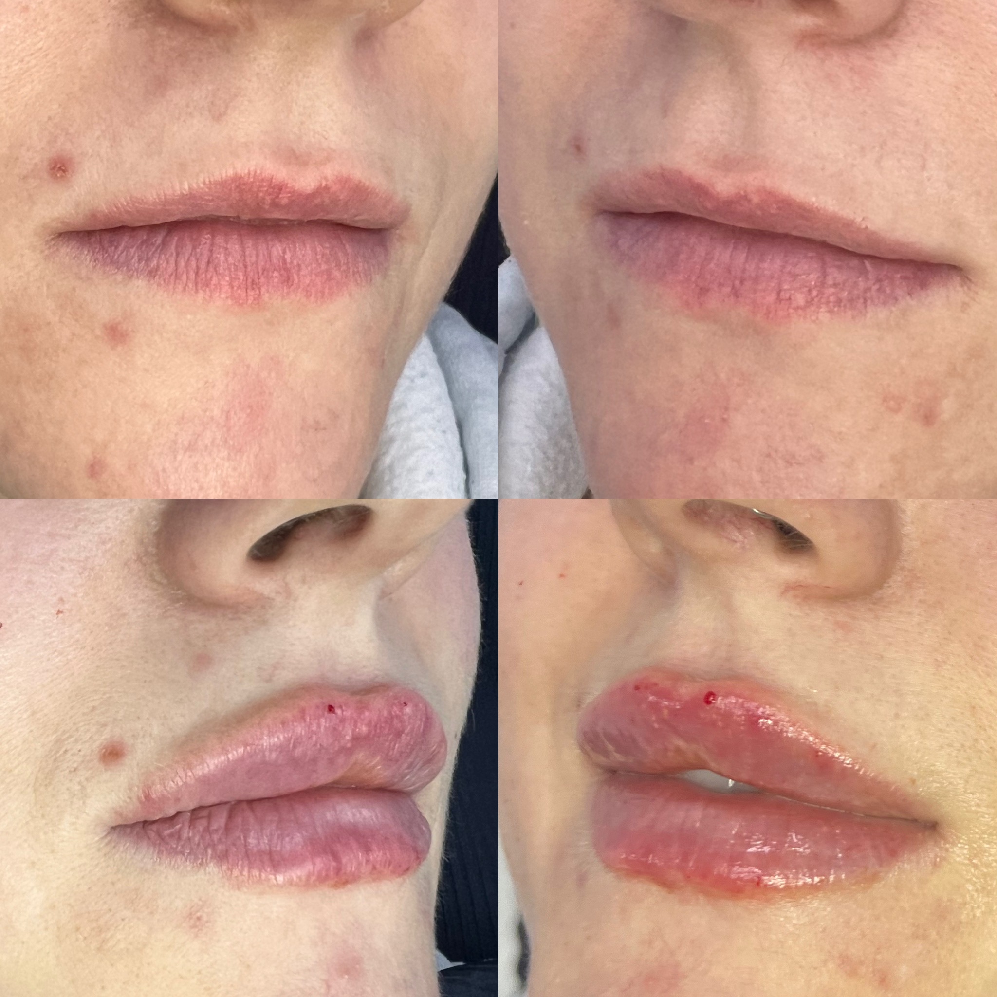 Before and after treatment result